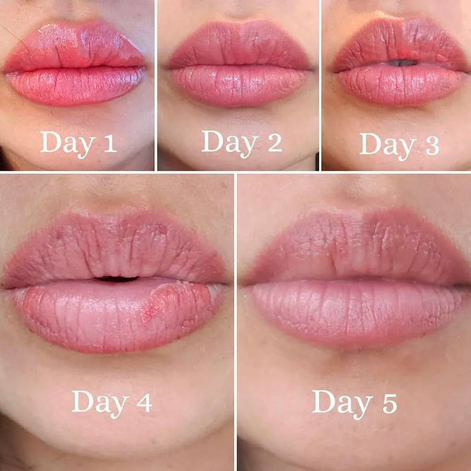 Шелушение губ после перманентного макияжа