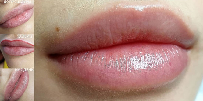 Перманентный макияж губ с высветлением
